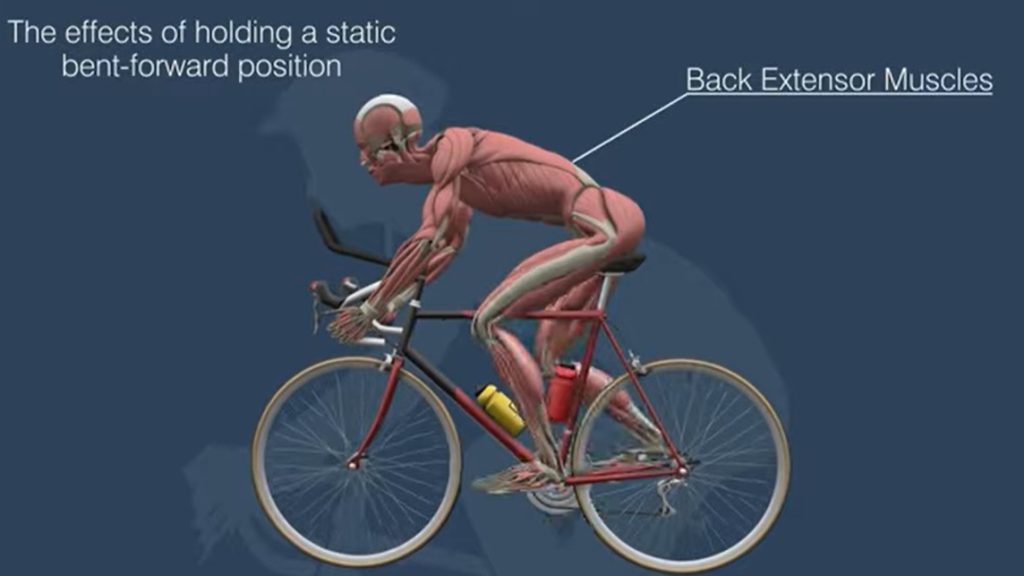 Do Road Bikes Cause Back Pain